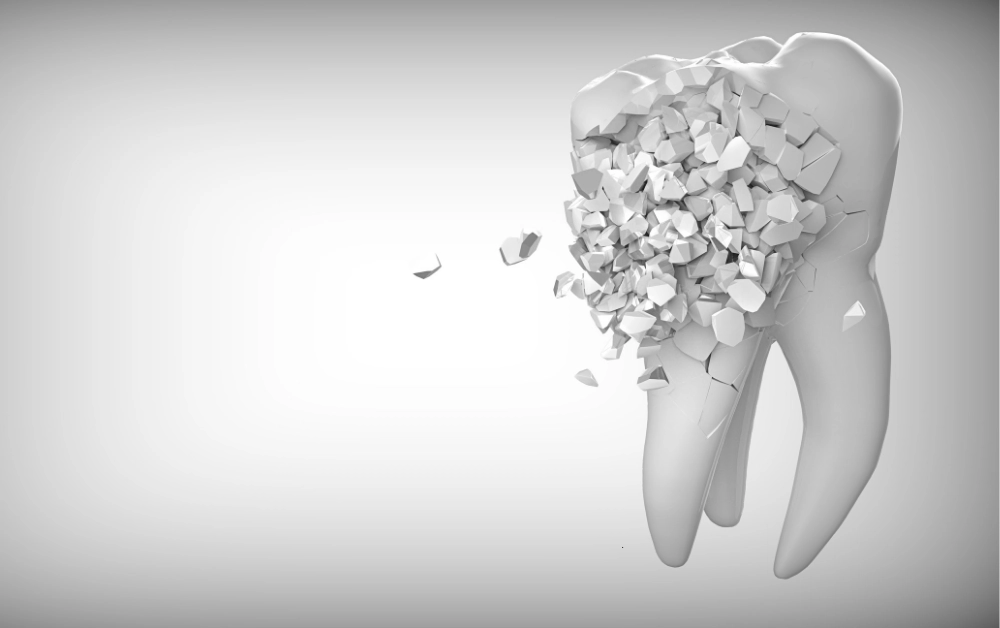 How Much To Fix A Chipped Tooth With Insurance Payzenic