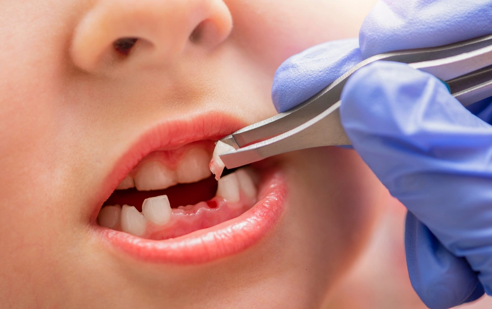 How Much To Pull A Tooth Without Insurance Payzenic